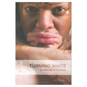 Turning White: A Memoir of Change Book