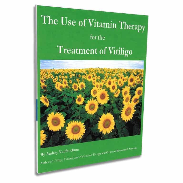 The Use of Vitamin Therapy for the Treatment of Vitiligo book Front