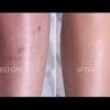 Camouflage Makeup Spray covers Bruises